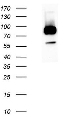 Monoclonal Mouse anti-Human GPR49 / LGR5 Antibody (clone UMAB212, aa22-543, IHC, IF, WB)