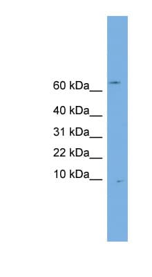 OTOS Antibody (N-Terminus)