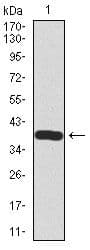 SST / Somatostatin Antibody (Amino Acid: 1-116, clone 7G5)