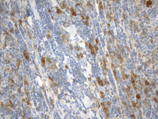 CD38 Antibody (aa43-300, clone UMAB263)
