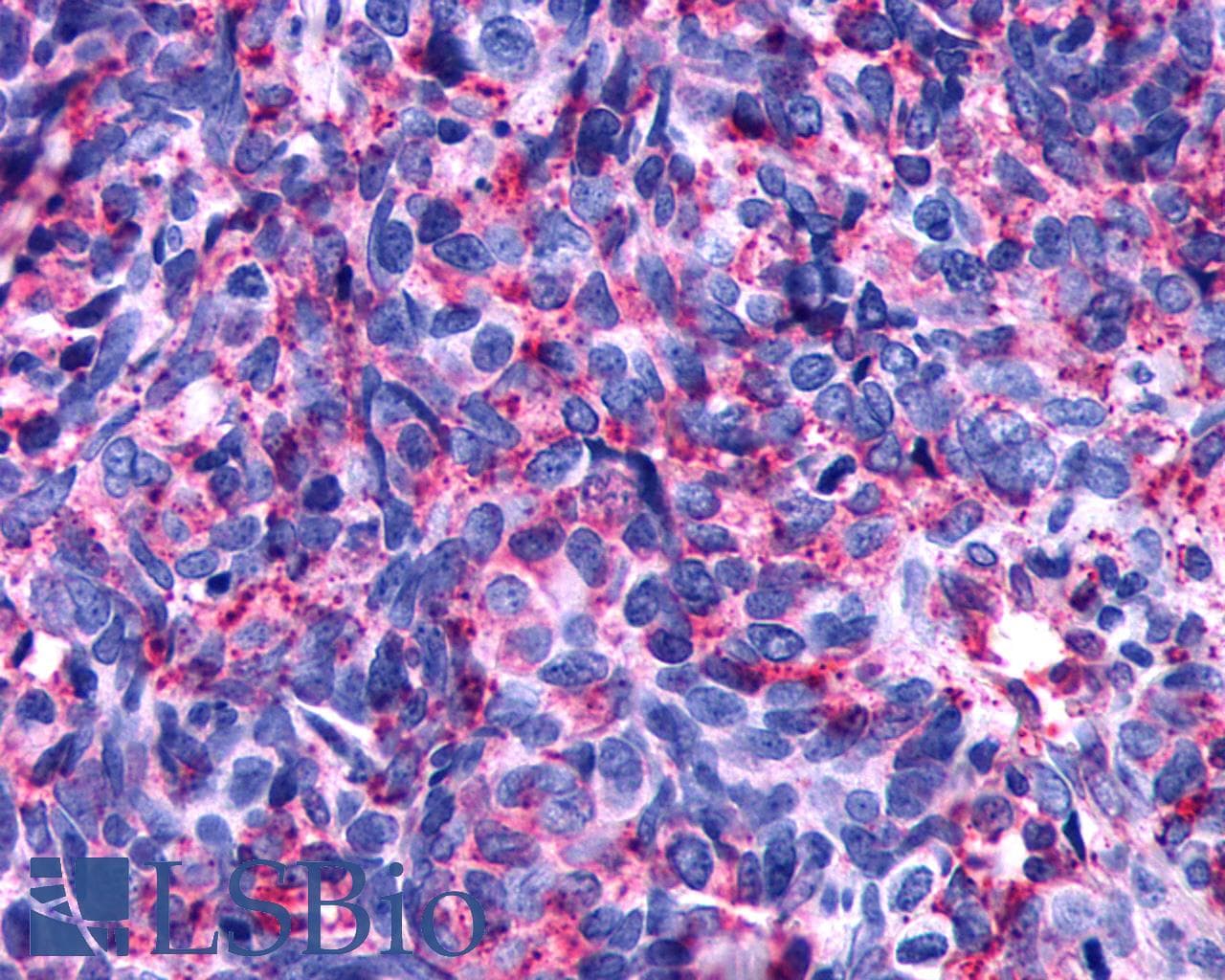 PathPlus™ Polyclonal Rabbit anti-Human DRD4 / Dopamine Receptor D4 Antibody (C-Terminus, IHC)