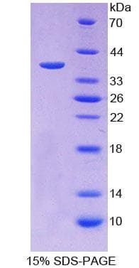 Human IDUA / MPS1 Protein (Recombinant His-T7)