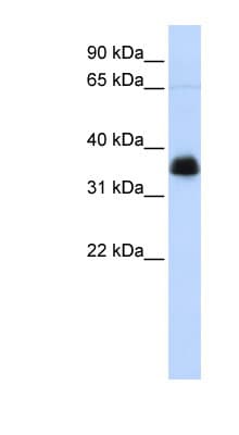 Polyclonal Rabbit anti-Human ARA9 / AIP Antibody (aa36-85, WB)