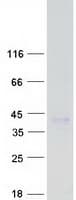 Human CD1E Protein (Recombinant Myc-DDK (Flag))
