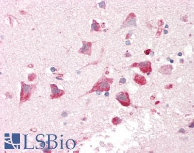 IHC-plus™ CAPRIN1 Antibody