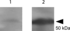 Tetanus Toxin Fragment C Antibody
