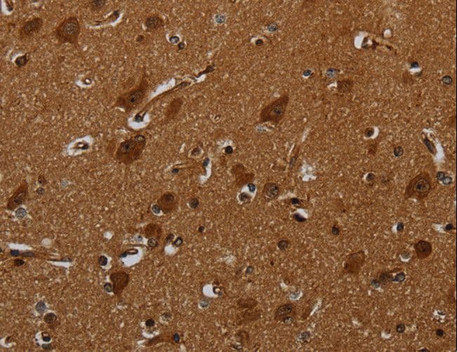 ENTPD7 Antibody