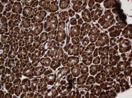 PAI-RBP1 / SERBP1 Antibody (aa1-262, clone OTI2C11)