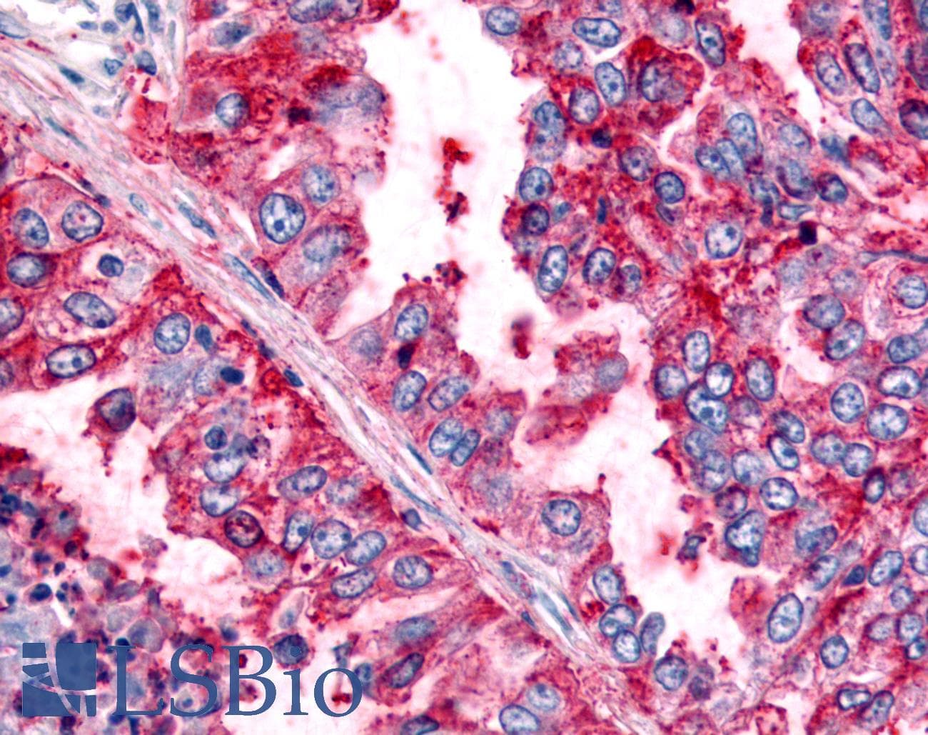 PathPlus™ Polyclonal Rabbit anti-Human PRKD2 / PKD2 Antibody (Internal, IHC)