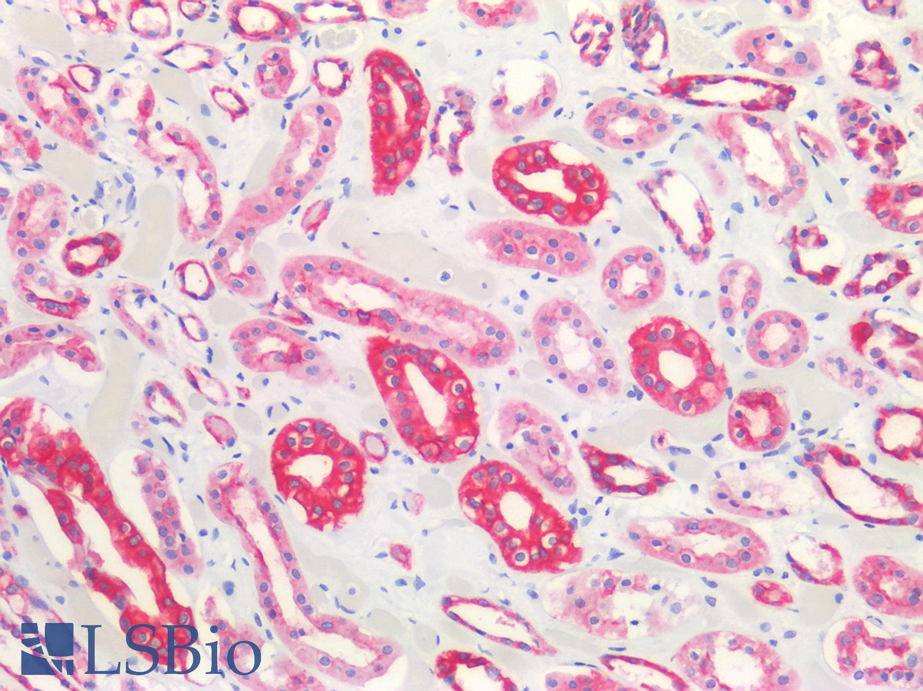 PathPlus™ CLDN4 / Claudin 4 Antibody (C-Terminus)