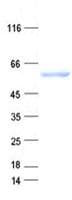 Human TBL1XR1 / TBLR1 Protein (Recombinant His, N-Terminal)