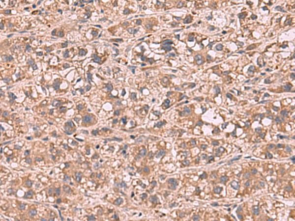 SHC4 Antibody
