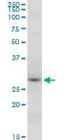 Monoclonal Mouse anti-Human RNF2 / RING2 / RING1B Antibody (clone 2B4, WB)