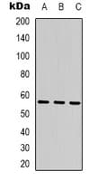 Polyclonal Rabbit anti-Human PA26 / SESN1 Antibody (Internal, IHC, WB)