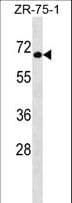 GTF3C5 Antibody (aa287-316)