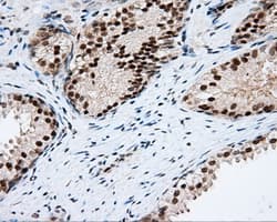 Monoclonal Mouse anti-Human PIM2 / Pim-2 Antibody (clone OTI8B4, IHC, IF, WB)