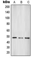 Polyclonal Rabbit anti-Human SUV39H2 Antibody (Internal, WB)