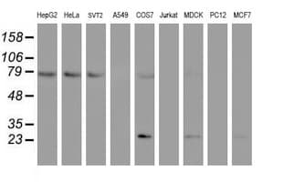 FOLH1 / PSMA Antibody (clone OTI3E8)