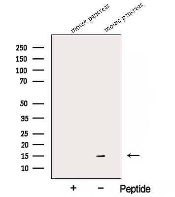 Polyclonal Rabbit anti-Human MANF / ARMET Antibody (WB)