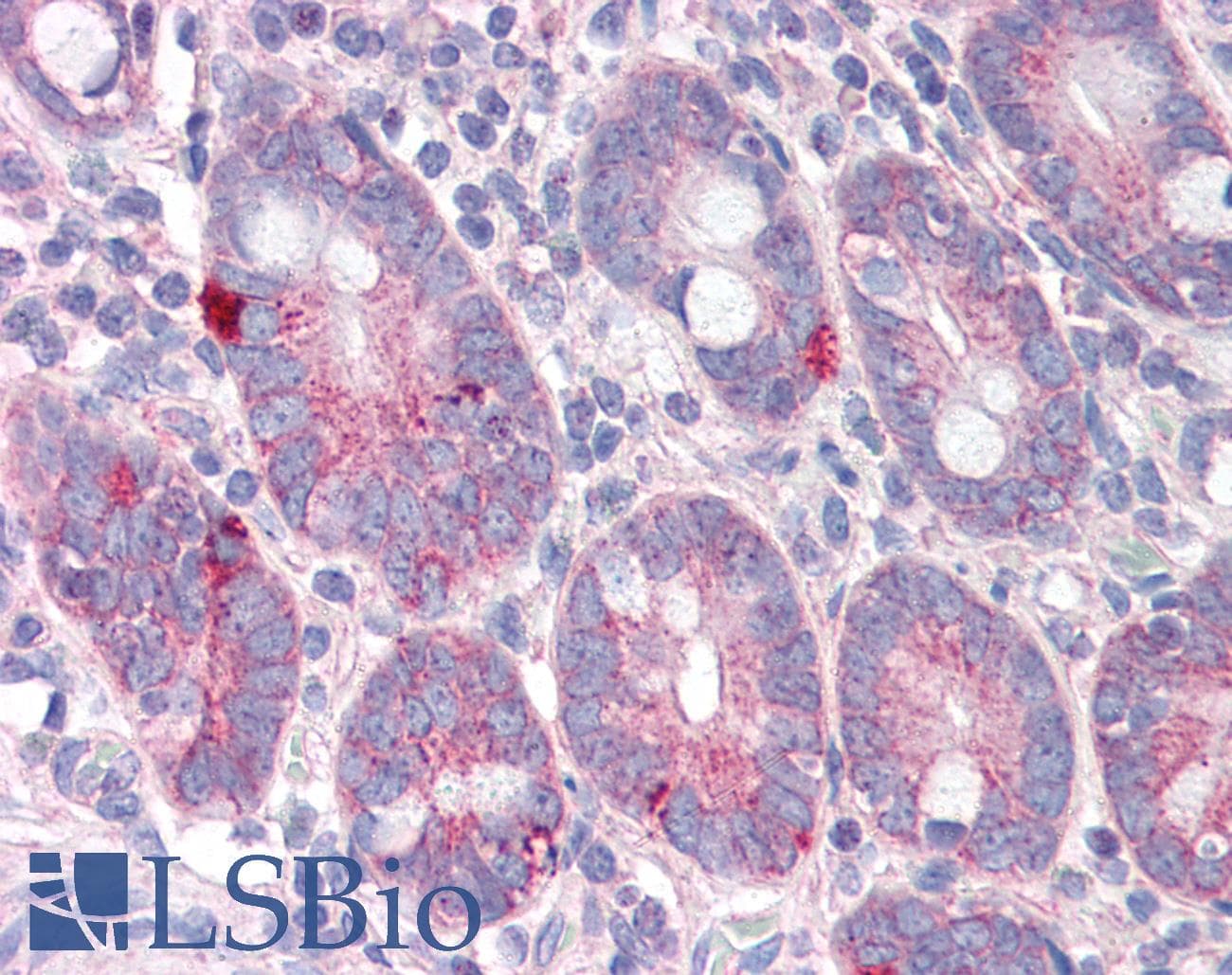 IHC-plus™ SLC9A1 / NHE1 Antibody
