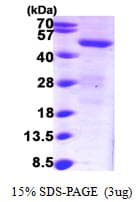 Human SNX1 Protein (Recombinant His)