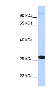 ZNF688 Antibody (aa72-121)