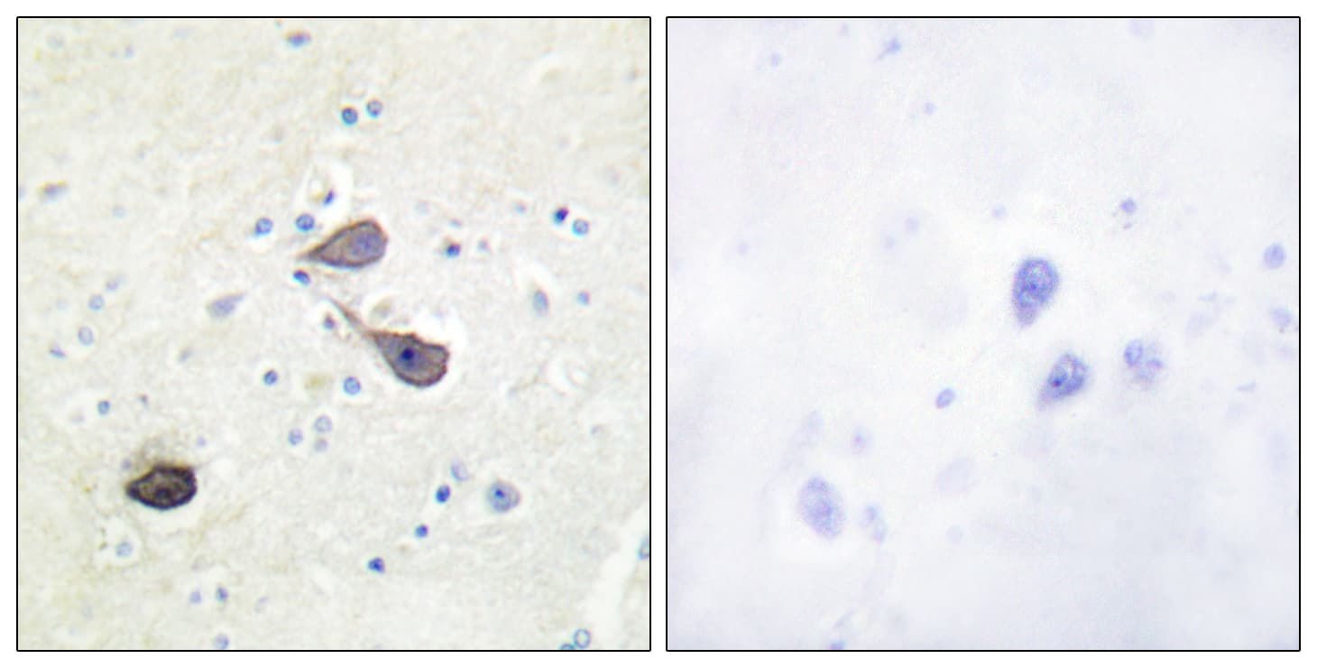 OPRK1 / Kappa Opioid Receptor Antibody (aa331-380)