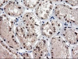 NUDT18 Antibody (clone OTI5D7)
