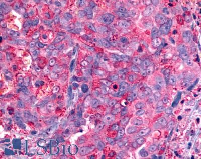 PathPlus™ Polyclonal Rabbit anti-Human GALR2 / Galanin Receptor 2 Antibody (Transmembrane Domain, IHC)