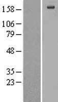 Human A2M / Alpha-2-Macroglobulin Protein (Over-Expression Lysate Myc-DDK (Flag))