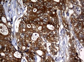 Monoclonal Mouse anti-Human NME1 / NM23 Antibody (clone OTI7F2, IHC, WB)