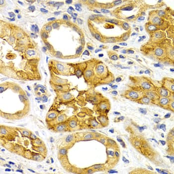 CXCR3 Antibody (aa289-368)