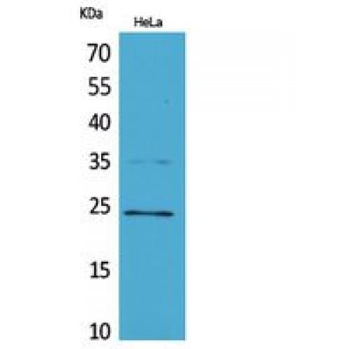 RAB5A / RAB5 Antibody (71-120 aa, Internal)