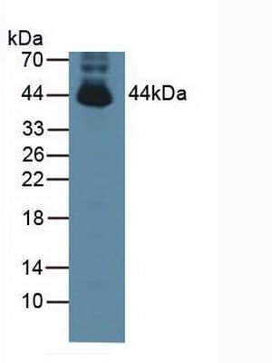 PTPN2 / TC-PTP Antibody