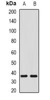 Polyclonal Rabbit anti-Mouse SHOX2 Antibody (WB)
