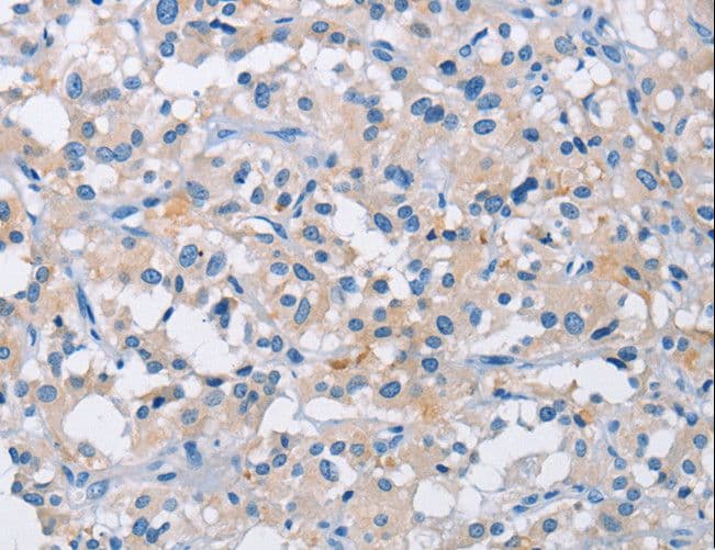 Polyclonal Rabbit anti-Human ATP6AP2 / Renin Receptor Antibody (IHC)