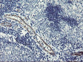 PGM3 Antibody (clone OTI1B8)