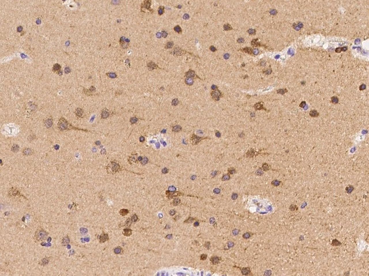 DPYSL5 / CRMP5 Antibody