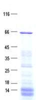 Human CCDC102B Protein (Recombinant His, N-Terminal)
