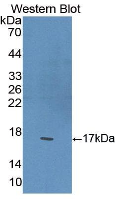 PPARG / PPAR Gamma Antibody (aa149-273, APC)