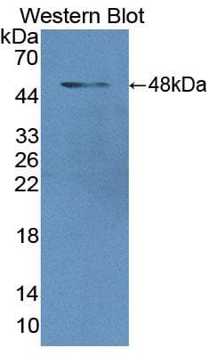 HBB / Hemoglobin Beta Antibody (aa1-147, FITC)