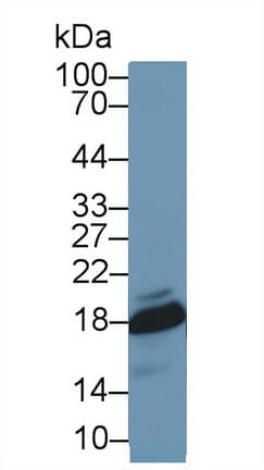 SOD1 / Cu-Zn SOD Antibody (aa2-154, APC)