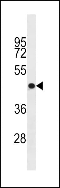 IHC-plus™ Polyclonal Rabbit anti-Human OR4S1 Antibody (aa282-309, IHC, WB)