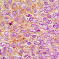 IQCB1 Antibody (Internal)