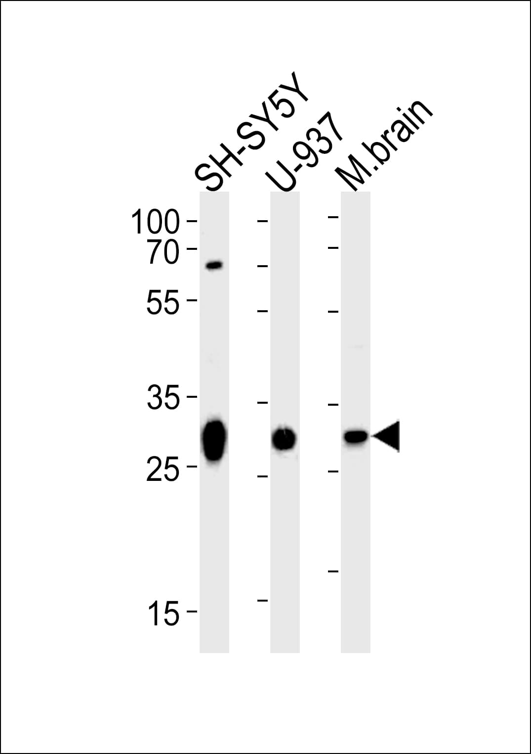 Polyclonal Rabbit anti-Human PHAP III / ANP32E Antibody (aa21-44, IF, WB)