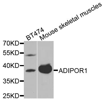 IHC-plus™ ADIPOR1/Adiponectin Receptor 1 Antibody