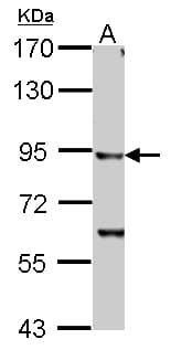 IKBKB / IKK2 / IKK Beta Antibody (aa493-739)