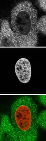 IHC-plus™ Polyclonal Goat anti-Human KPNA2 / Importin Alpha 1 Antibody (aa518-529, IHC, WB)