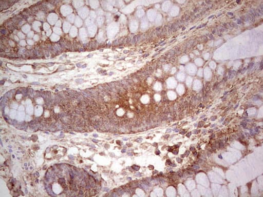 UBE2D2 / UBCH5B Antibody (clone OTI2C2)
