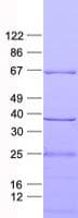 Human GLS2 / Glutaminase 2 Protein (Recombinant His, N-Terminal)